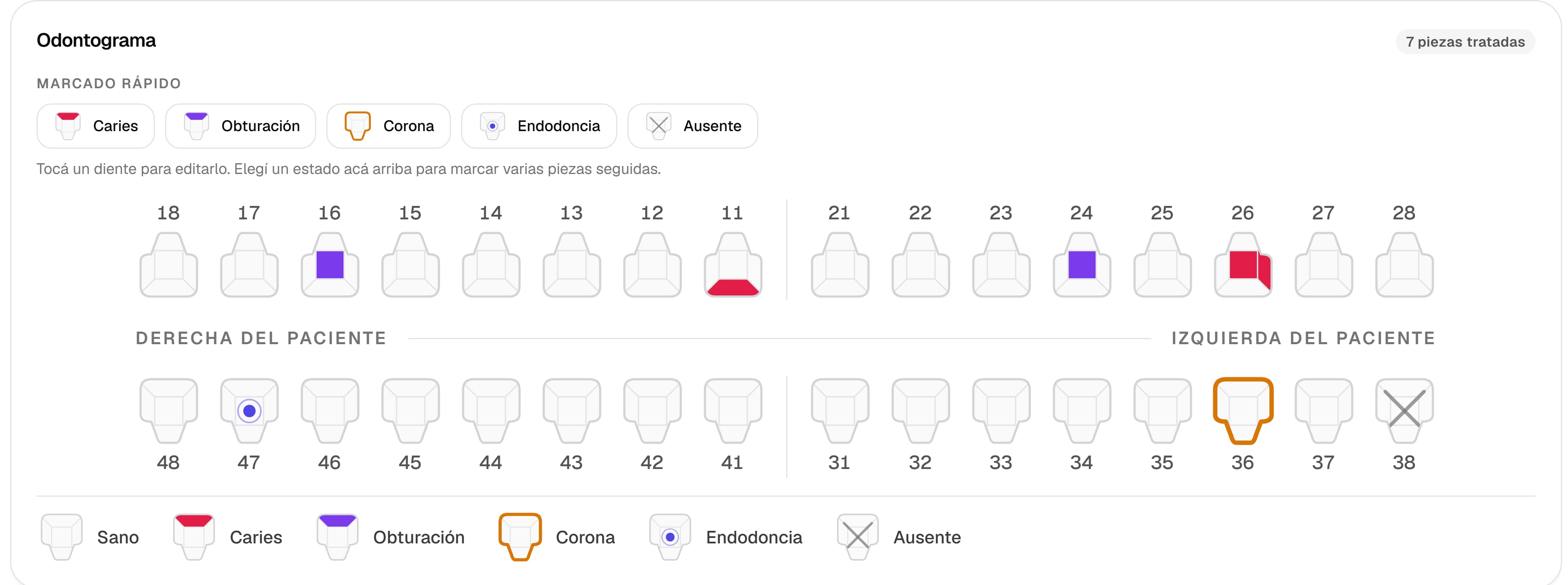 Odontograma con piezas marcadas como caries, obturación, corona, endodoncia y ausente